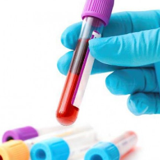 Bloed afname door huisartsenlab in de apotheek